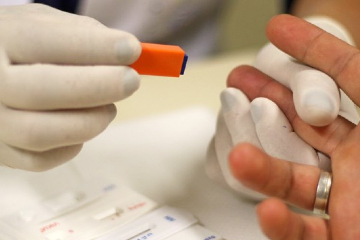 Ministério da Saúde orienta farmácias a realizar testes rápidos de HIV