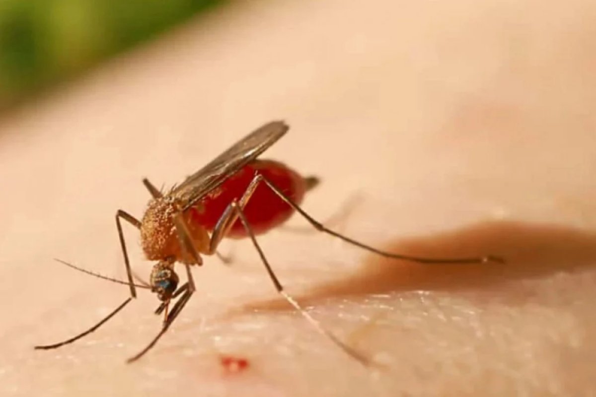Especialistas temem que febre Oropouche possa desencadear novo surto de microcefalia no Brasil