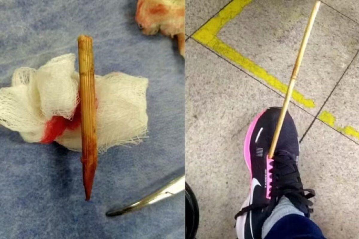 Mulher é atingida por "flecha" durante caminhada em BH