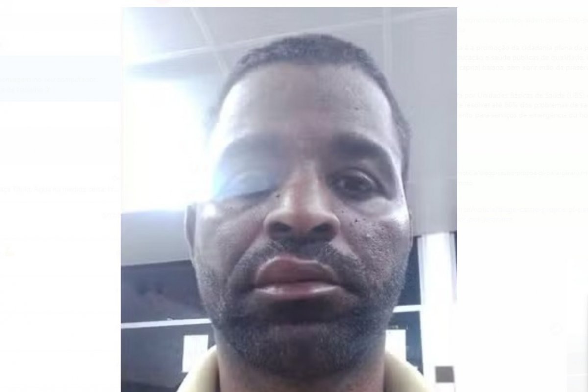 Briga entre motorista por aplicativo e passageira termina com agressão na Av. Paralela