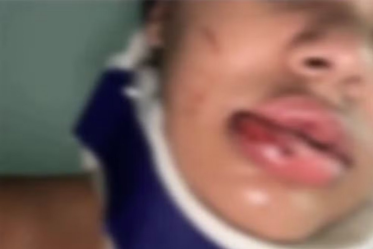 Jovem pula de motocicleta para fugir de agressões do companheiro no sul da Bahia