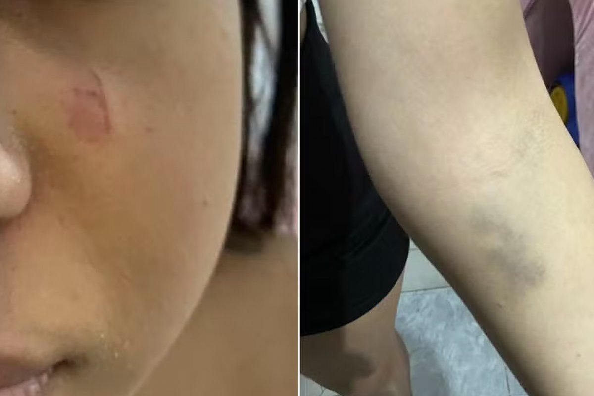 Adolescente é agredida por mulher de 25 anos na porta de escola por conta de Pix de R$ 10