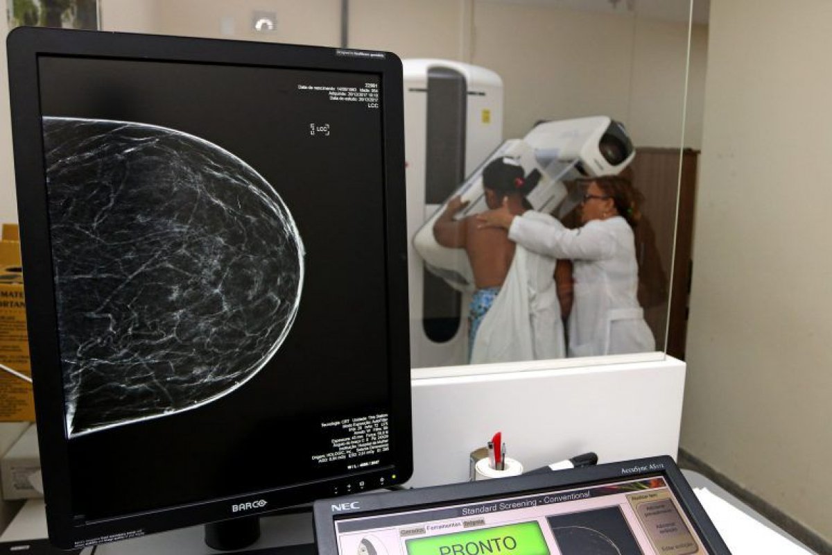 Outubro Rosa: detecção precoce do câncer de mama aumenta a chance de cura para mais de 90%