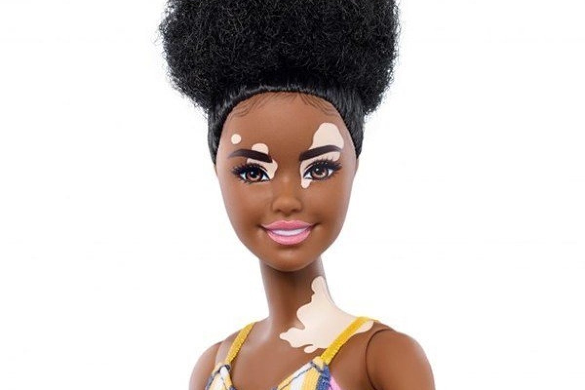 Barbie lança boneca com vitiligo