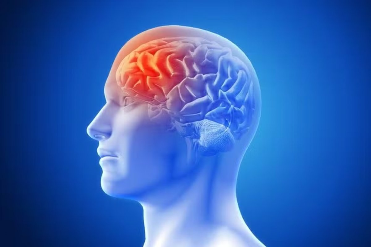 Dia do AVC: Sintomas, prevenção e tratamento. Fique por dentro!