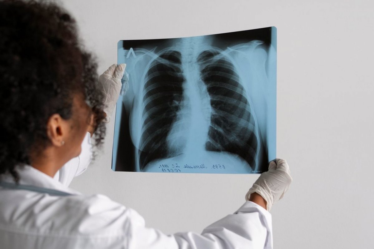Bahia registrou mais de 3.400 mortes por pneumonia em 2024; média é de 11 mortes por dia