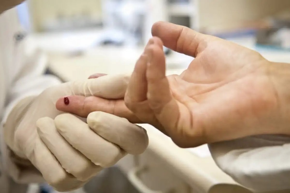 95% das pessoas em tratamento contra HIV no Brasil não transmitem a doença
