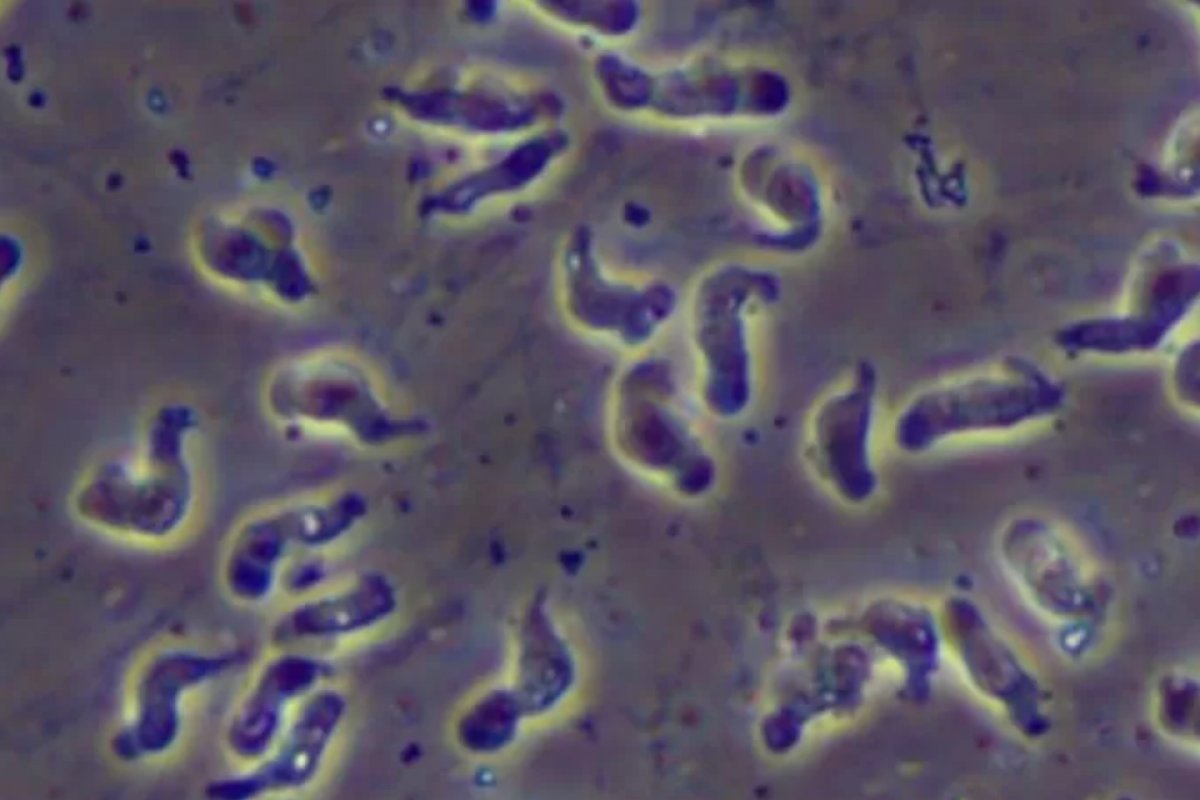 Ceará investiga morte por ameba rara conhecida como 'comedora de cérebro'