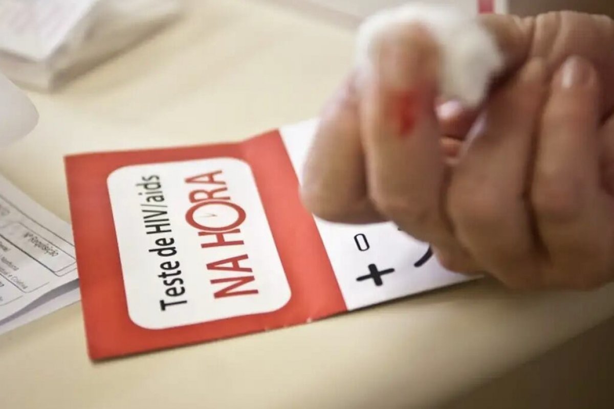 Quase 80% dos casos notificados de HIV/Aids na Bahia em 2024 são de pessoas entre 20 e 49 anos
