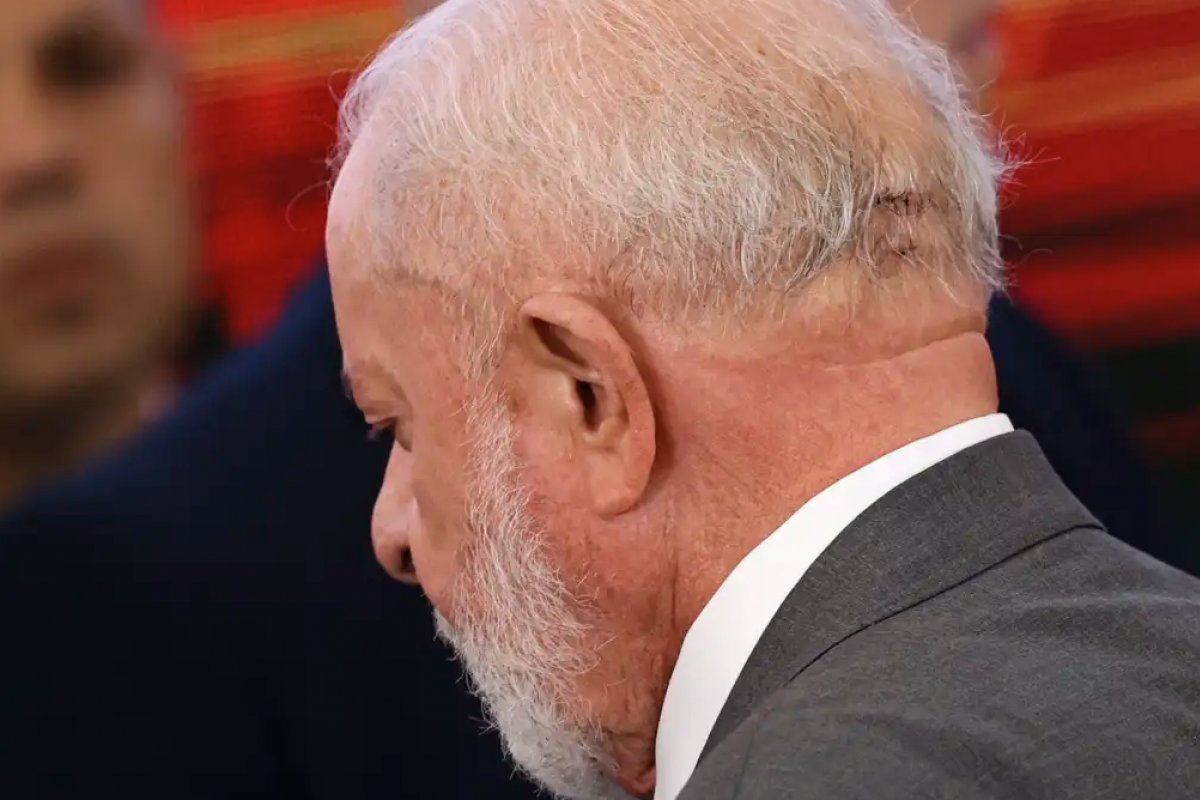 Lula realizou três procedimentos médicos desde a posse; saiba mais