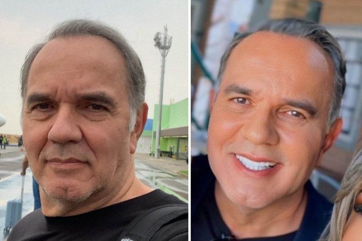 Humberto Martins se rende a harmonização facial!