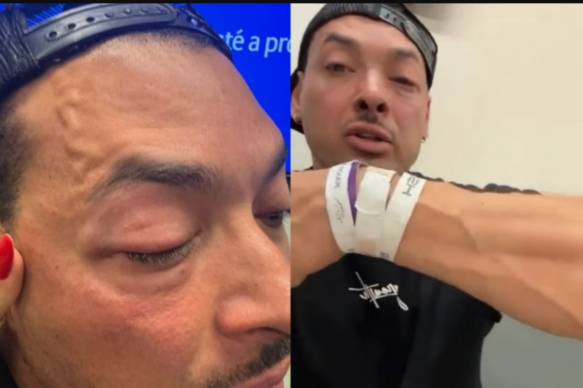 Vídeo: Deputado Felipe Franco denuncia agressão em show de Chris Brown