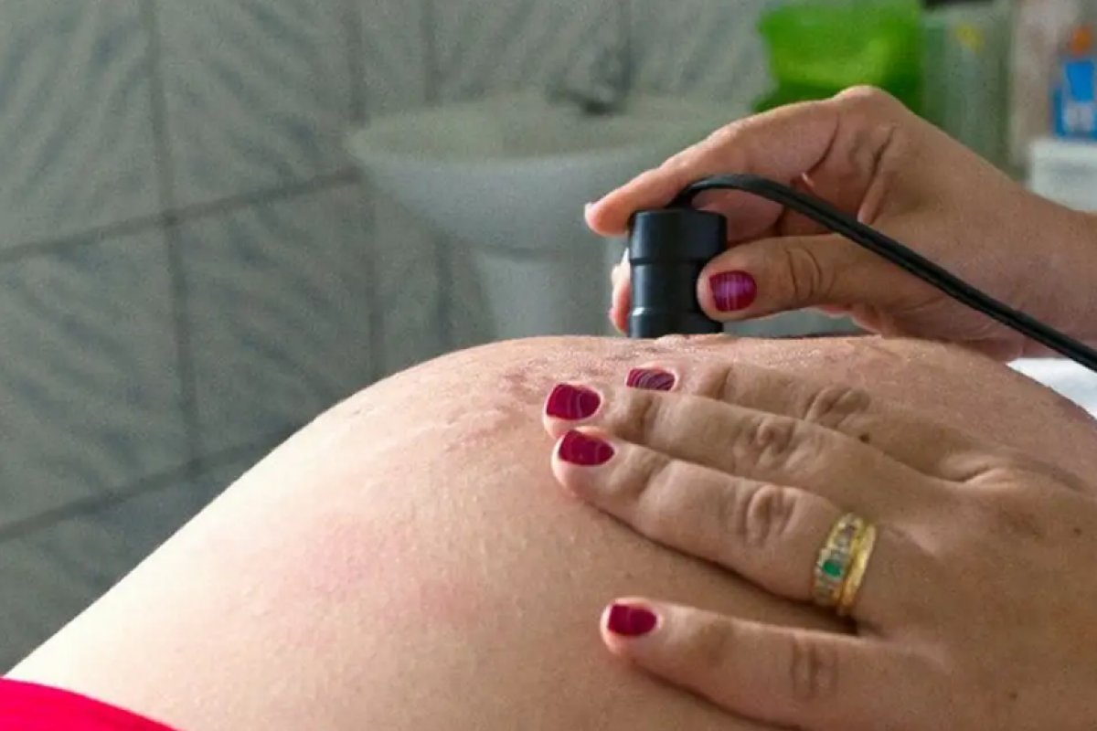 Brasil reduz partos na adolescência pela metade em uma década