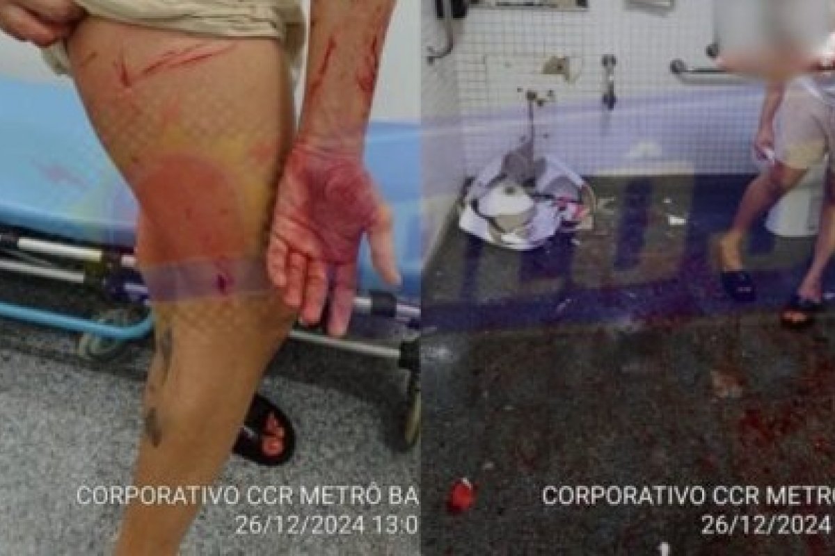 Pia cede e machuca homem durante relação sexual em banheiro de metrô em Salvador