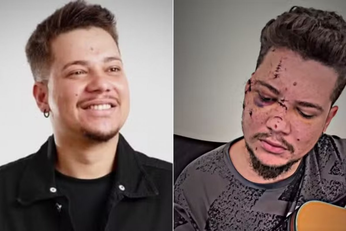 Sertanejo Benício leva 32 pontos no rosto após ser atacado com garrafa em show