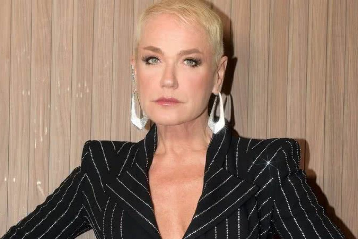 Xuxa Meneghel passa por cirurgia. Saiba tudo!