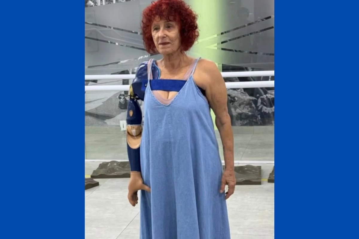 Escritora Roseana Murray ganha prótese biônica após perder braço em ataque de pitbulls