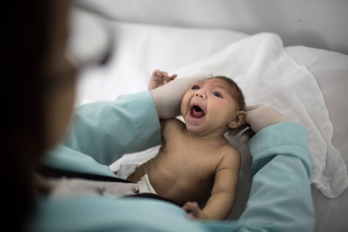Bahia registrou 83 notificações de sequelas relacionadas ao vírus da Zika