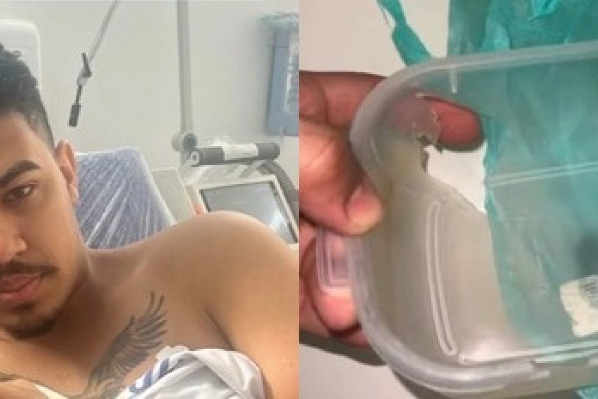 Barbeiro baleado em tentativa de assalto na RMS é salvo por marmita; entenda