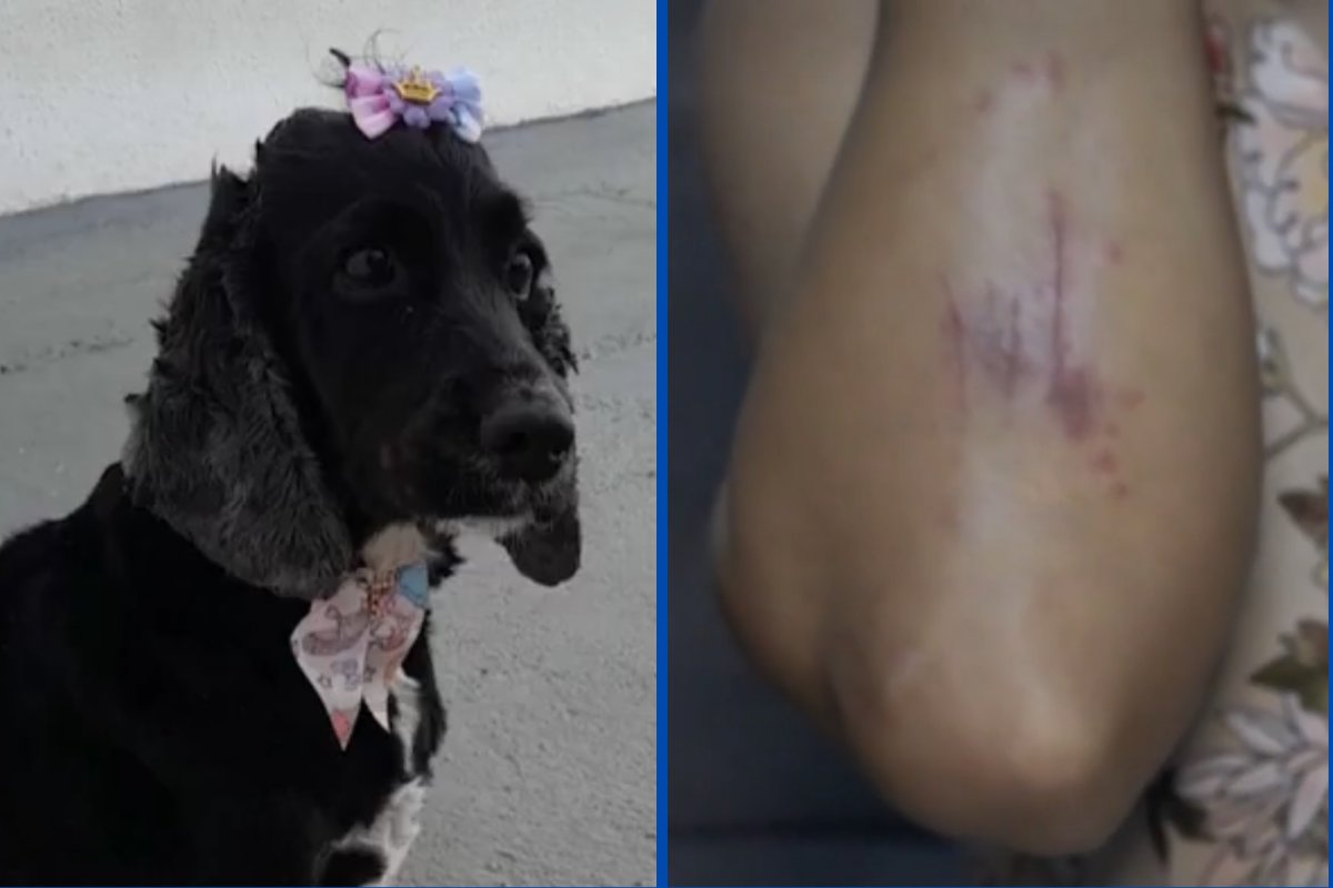 Mulher fica ferida e cadela morre após ataque de pitbull no sudoeste da Bahia