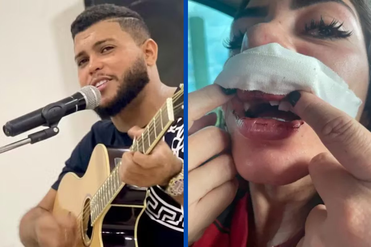 Cantor é suspeito de agredir namorada em Manaus; vítima perdeu três dentes durante agressões, diz advogada