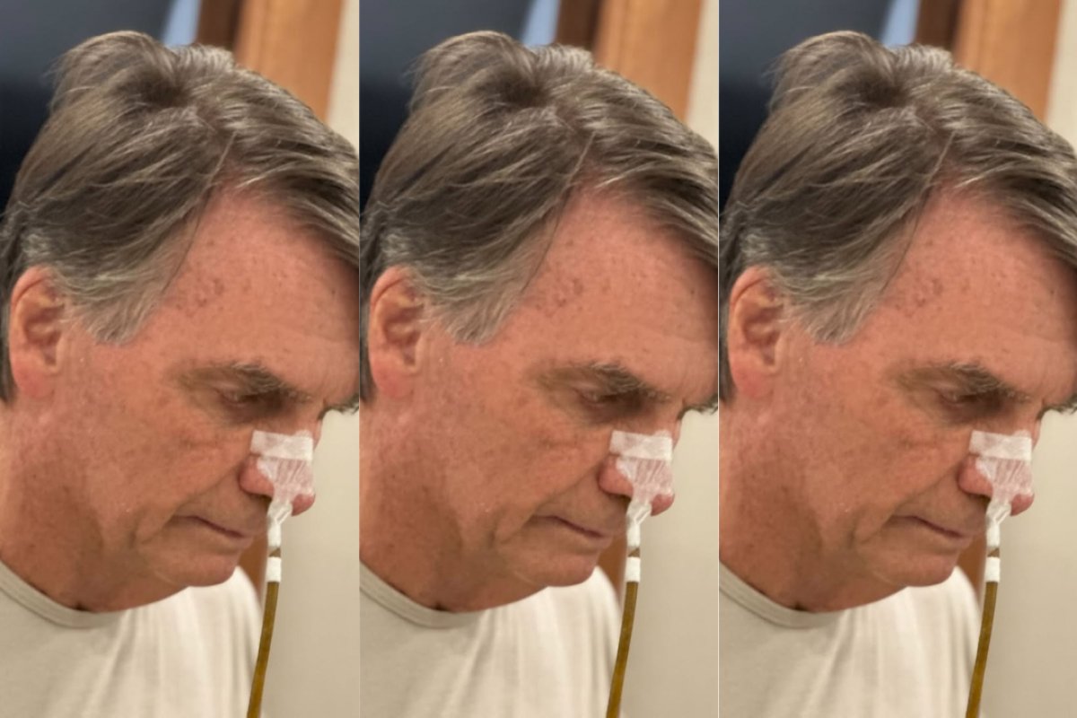 Bolsonaro apresenta "sinais efetivos de movimentação intestinal", segundo boletim médico