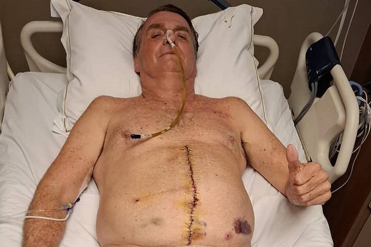 Bolsonaro expõe sondas e cicatrizes no hospital, e pesquisadores veem estética para unir apoiadores