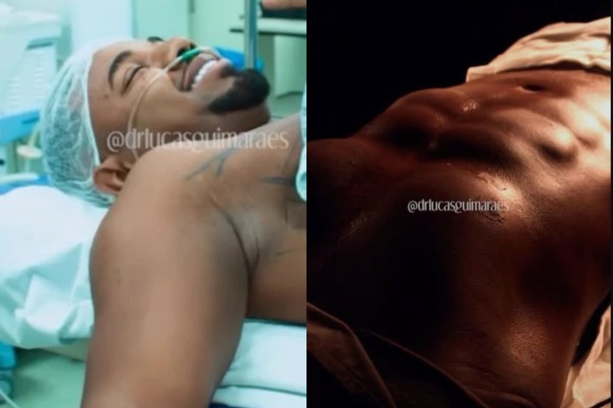 Vídeo: médico divulga transformação de Davi Britto após procedimento estético