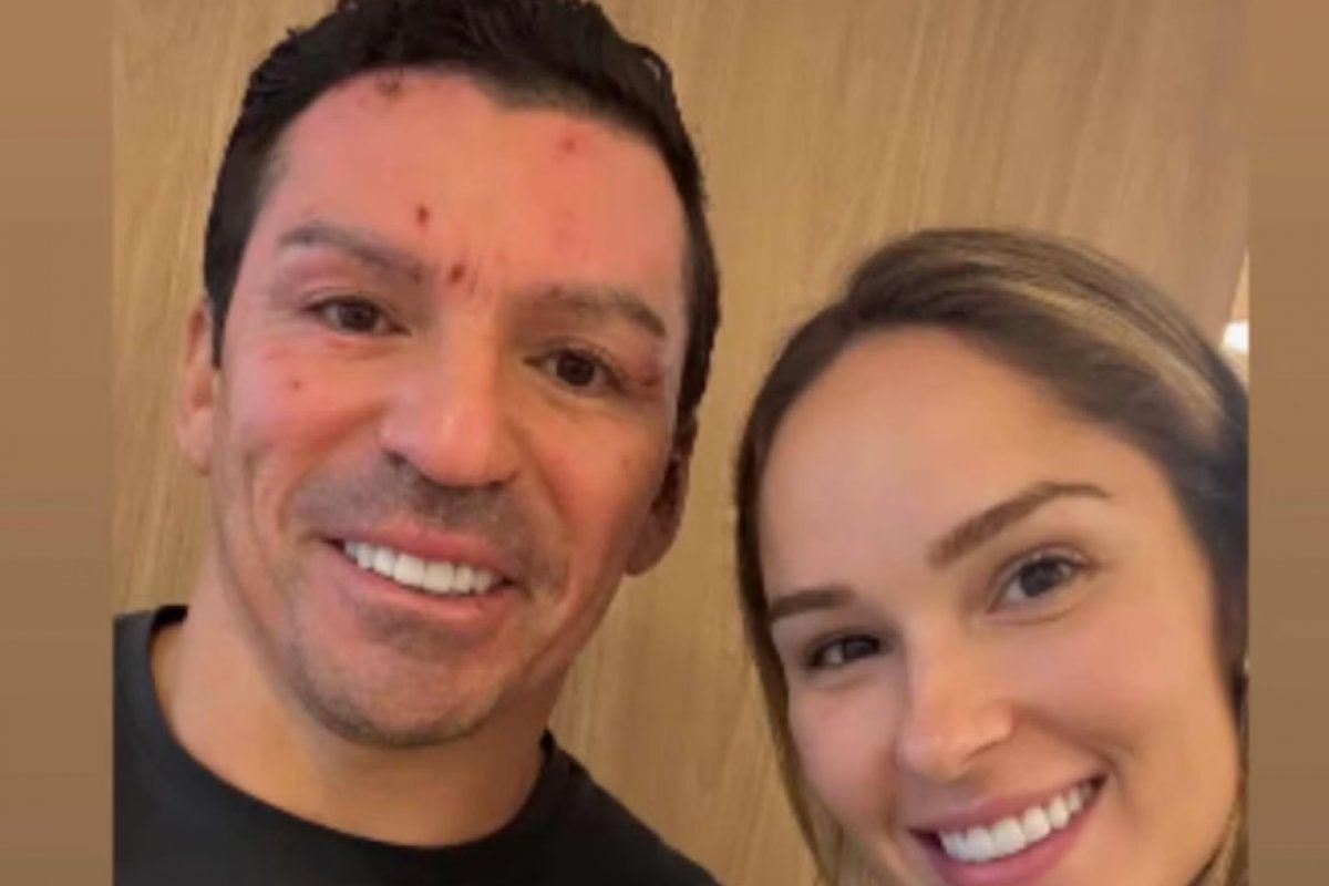 Ex-jogador Lúcio compartilha foto do rosto ao lado da esposa após acidente doméstico