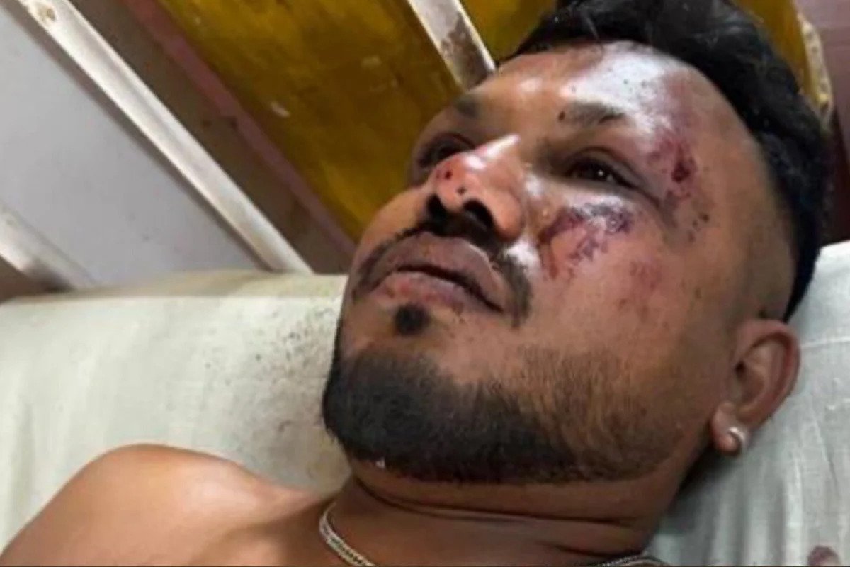 Vídeo: homem apontado como sobrevivente de queda de avião na Índia diz que se levantou e correu após o impacto