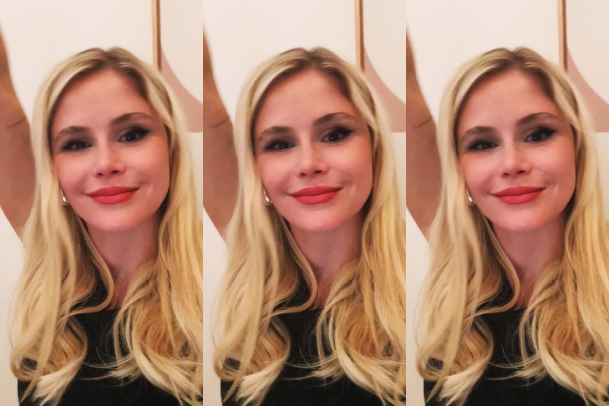 Entenda o que é doença de Graves, condição que atinge atriz de "The Boys"