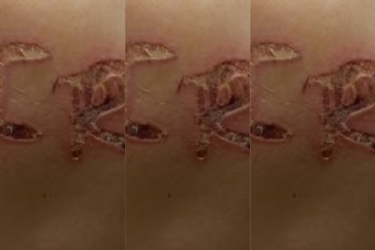 Marido é preso ao marcar iniciais do nome dele no corpo da esposa em Cosmorama