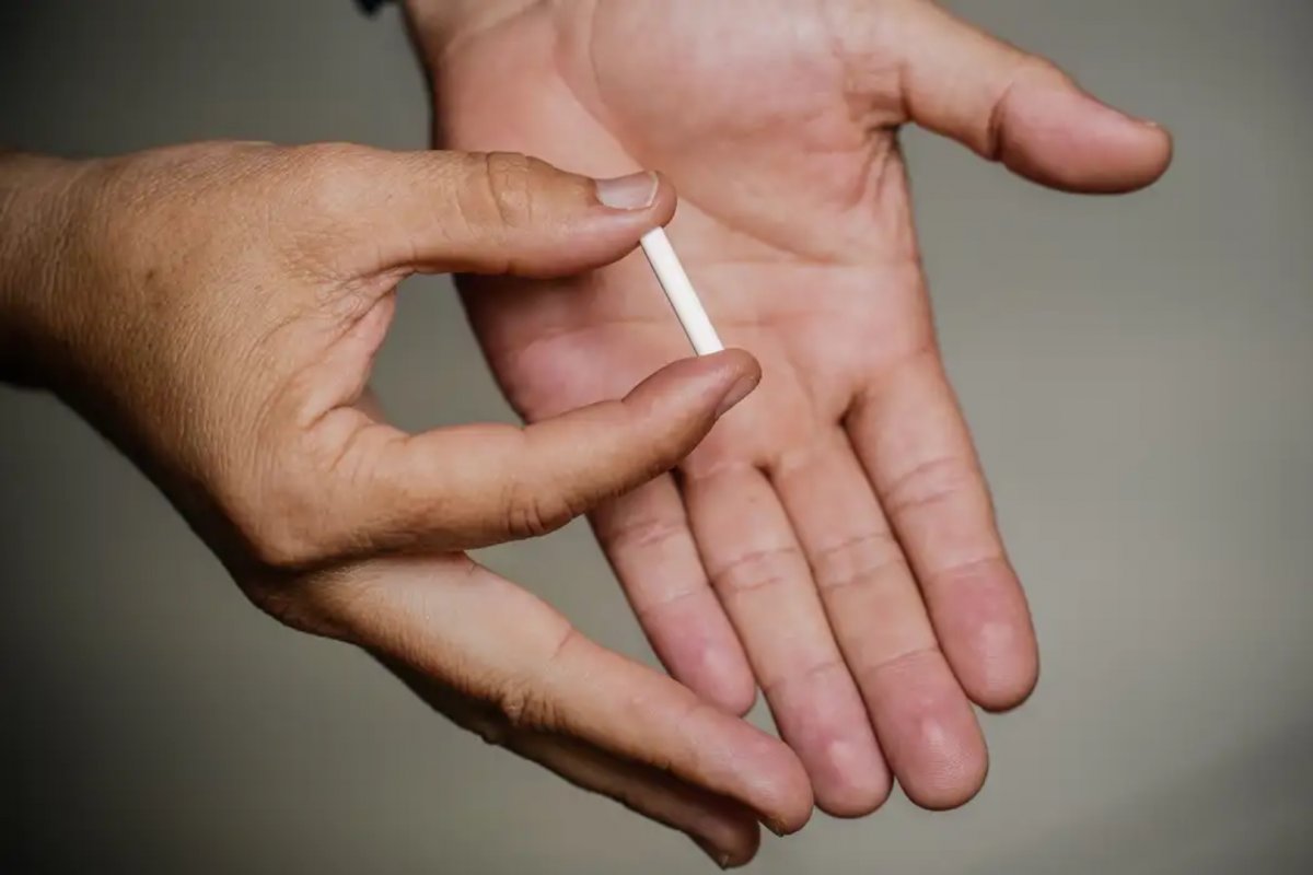 SUS oferecerá implante contraceptivo para mulheres em idade fértil a partir do segundo semestre