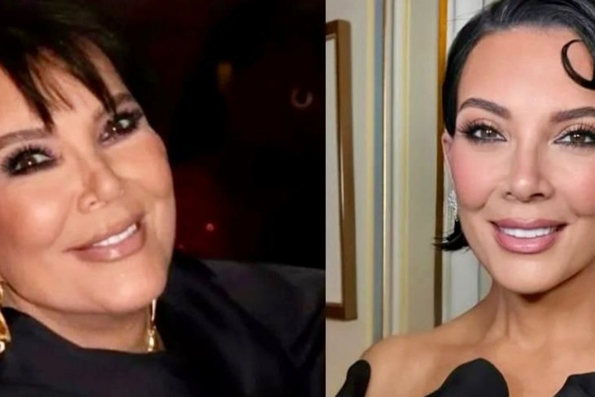 Cirurgião plástico baiano explica o efeito Kris Jenner - que rejuvenesce 20 anos em 10 dias com resultados naturais! 