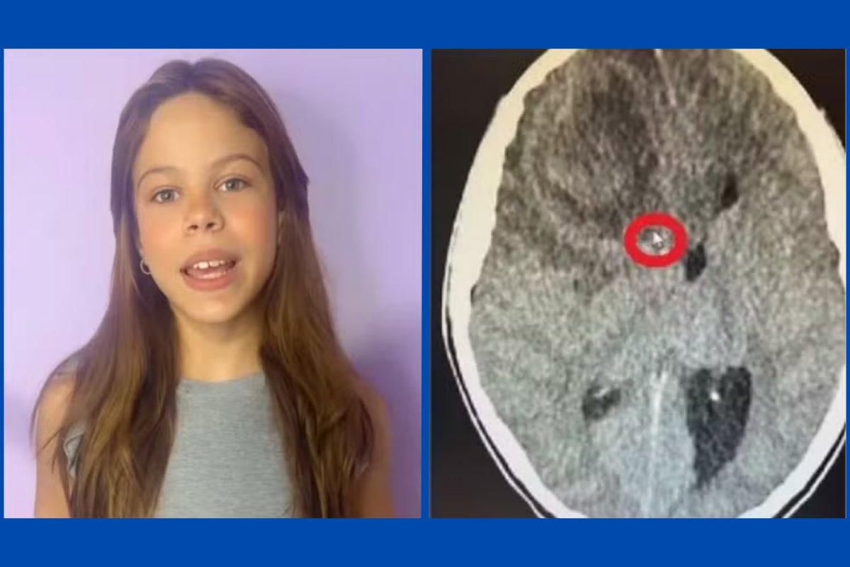 Perícia aponta infecção cerebral como causa da morte de Millena Brandão e pais da atriz mirim apontam negligência médica