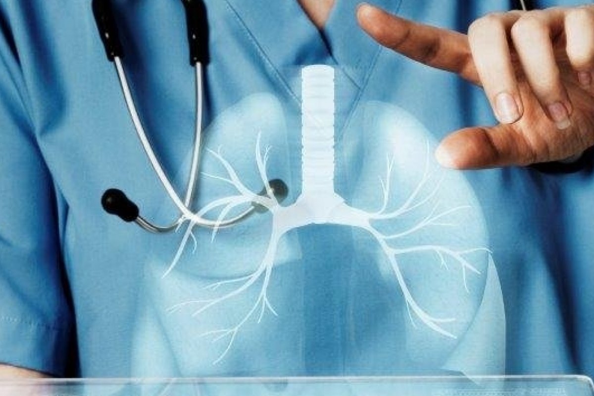 Agosto Branco: exame permite diagnosticar o câncer de pulmão em fases iniciais! 