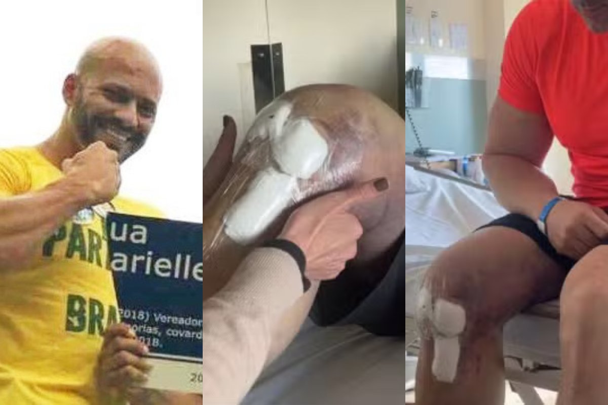 Moraes autoriza saídas temporárias de Daniel Silveira para tratamento de fisioterapia