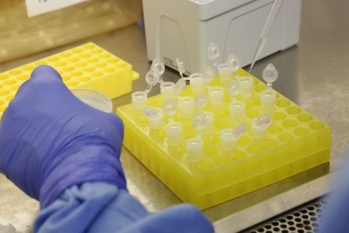 Especialista recomenda medicamentos antimalária contra coronavírus