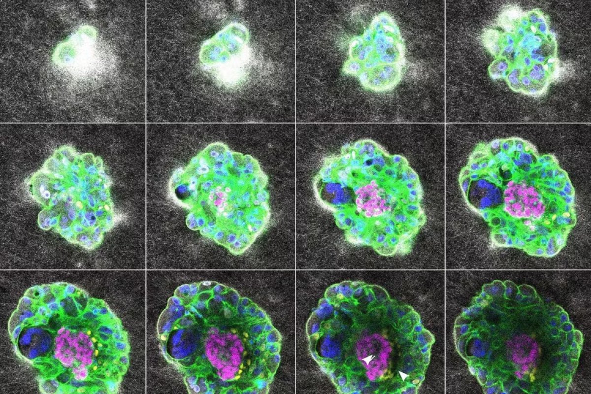 Vídeo: Pesquisadores espanhóis fazem o primeiro registro da implantação de um embrião humano