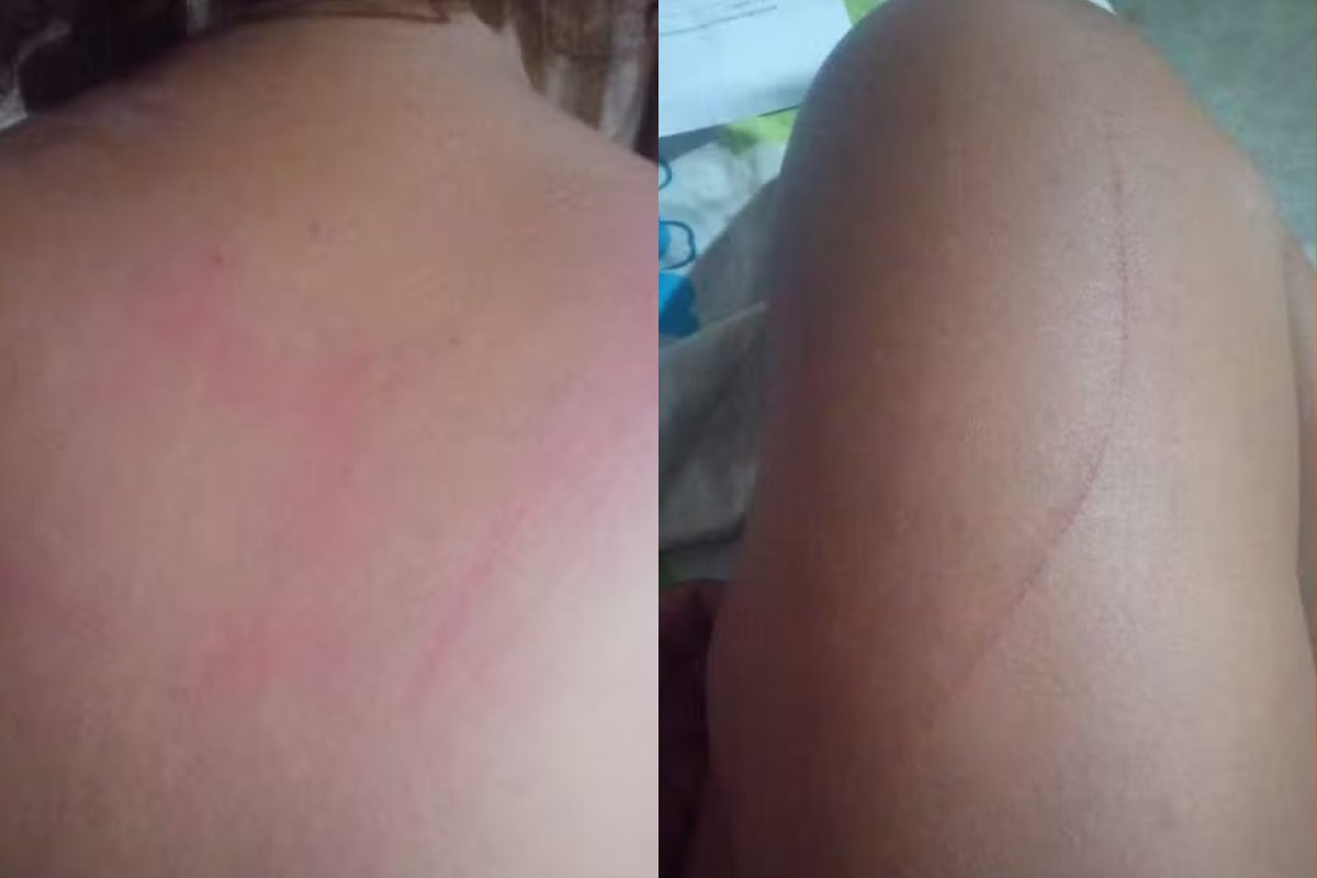 Garota de programa é estuprada por 3 homens na BA e pula de carro em movimento para fugir dos abusos