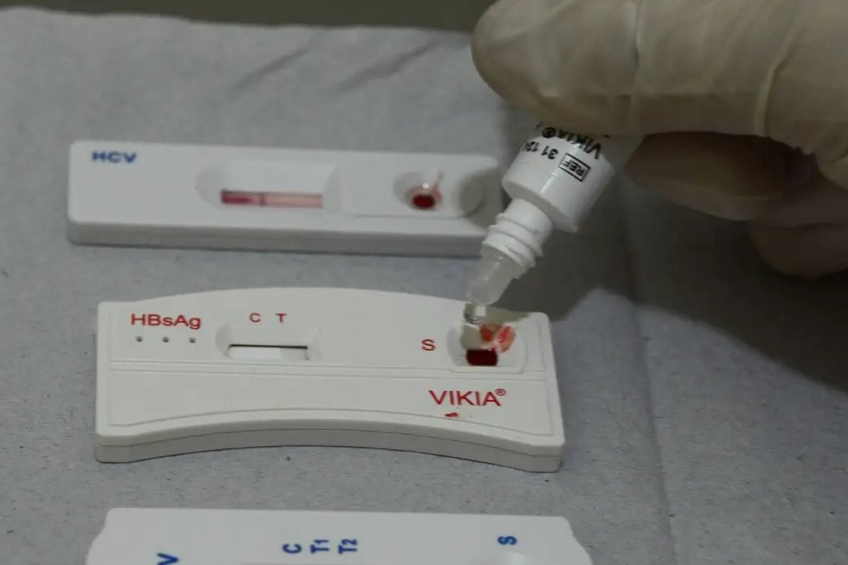 Não há surto de HIV entre jovens de 14 a 19 anos na Bahia, afirma Sesab