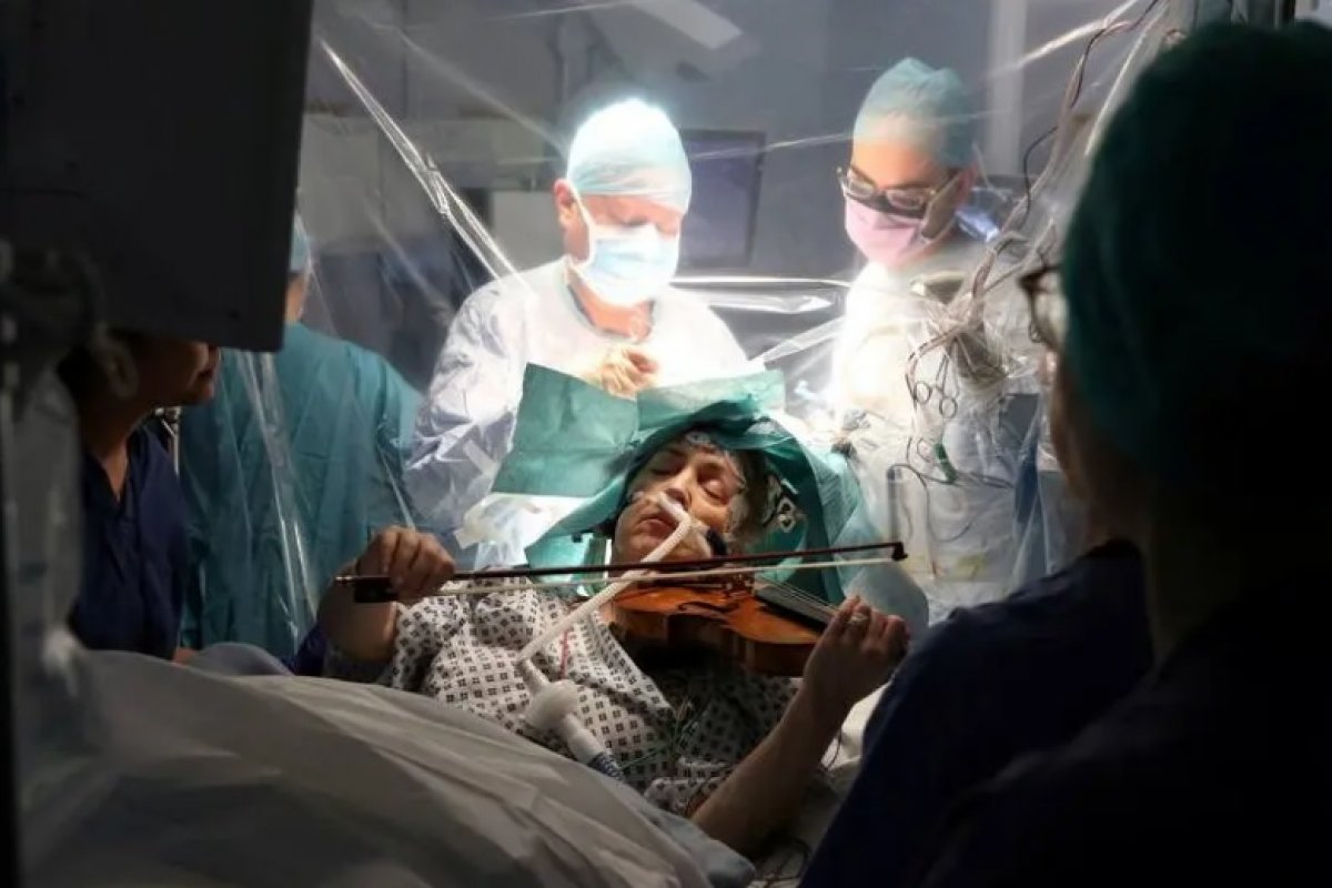 Paciente surpreende ao tocar violino durante cirurgia para retirada de tumor