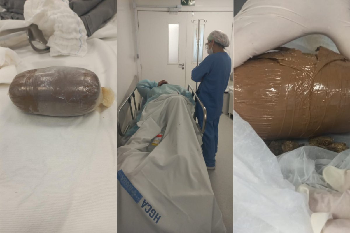 Grávida esconde droga em partes íntimas e passa mal em presídio de Feira de Santana