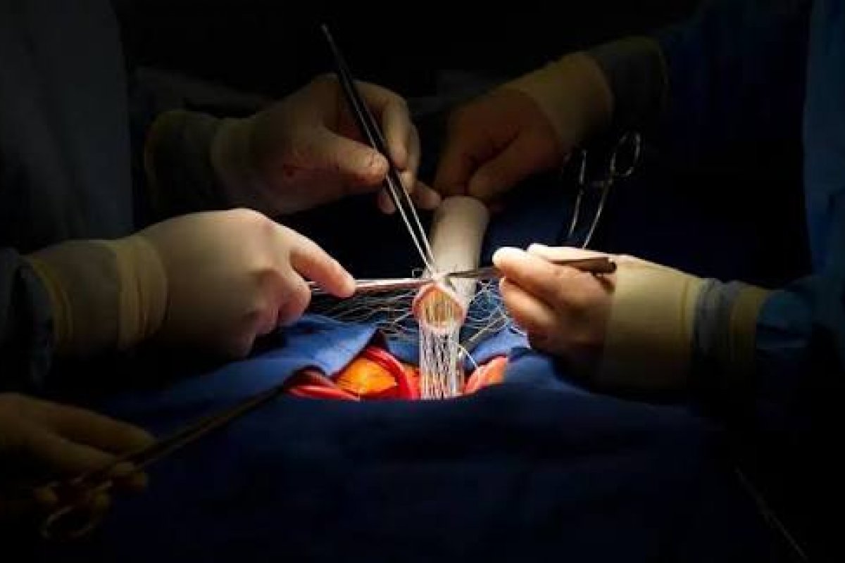 Jovem de 22 anos volta a ter qualidade de vida após operação cardíaca inédita!