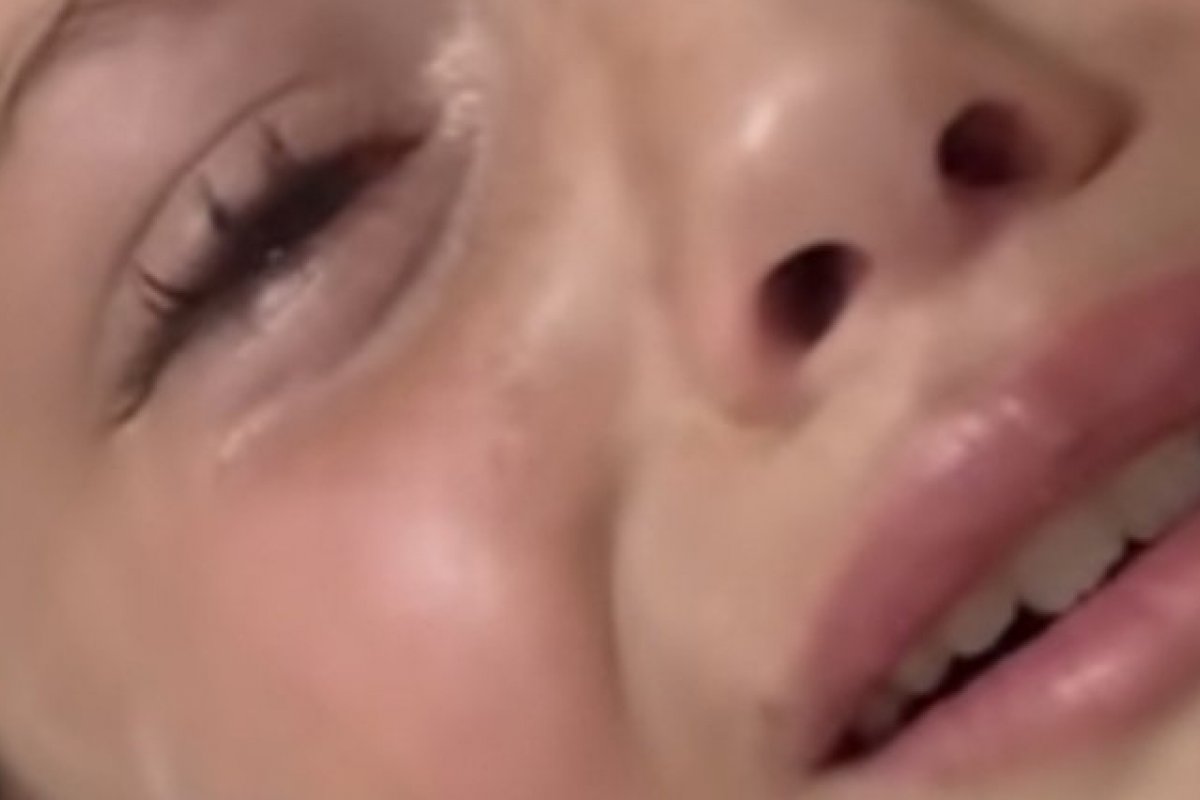 Criança tem caranguejo vivo retirado de ouvido após ida a praia!