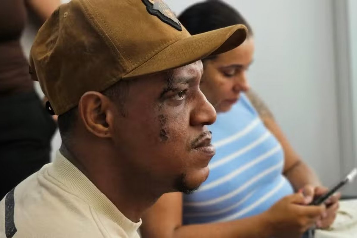 Dançarino do grupo Os Hawaianos denúncia agressão durante operação policial no RJ; imagem mostra funkeiro com rosto ensanguentado