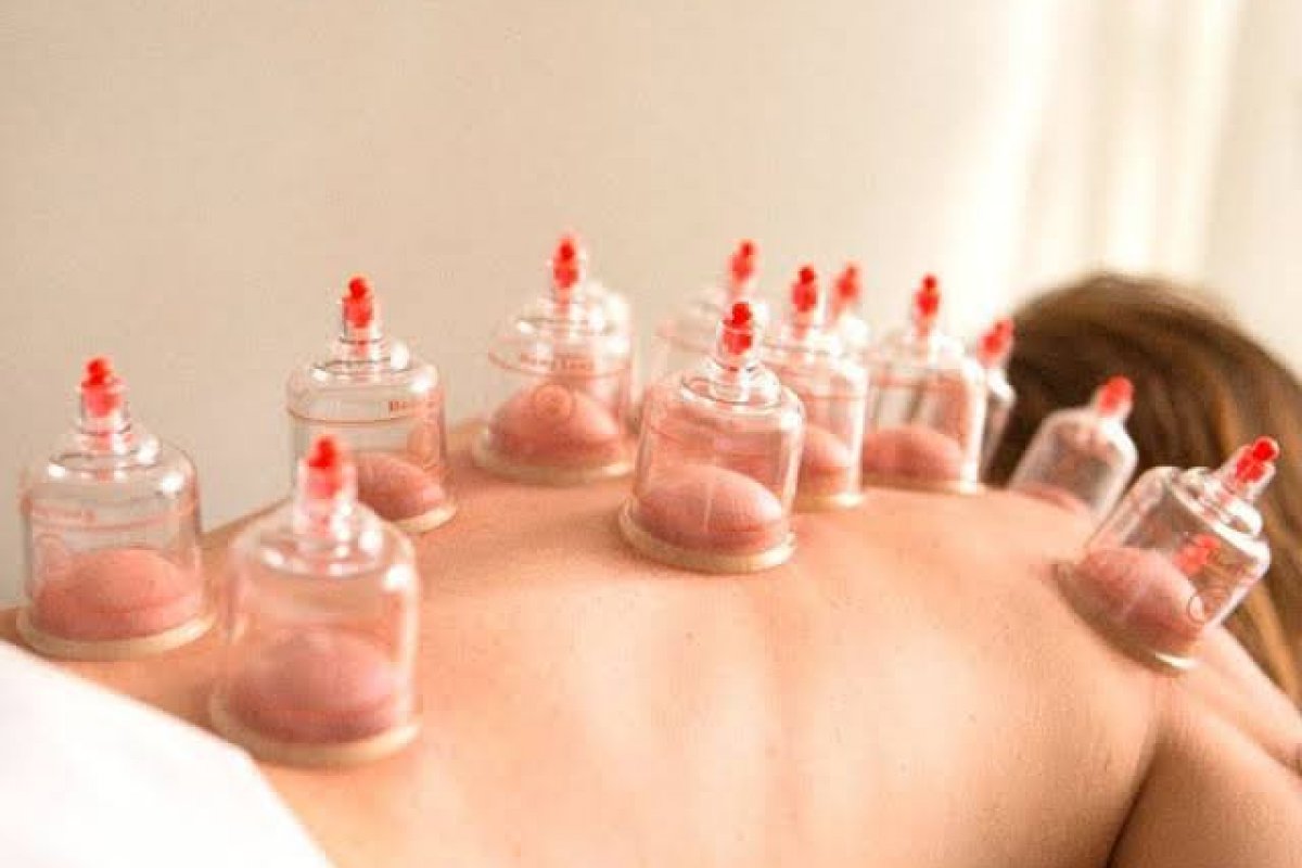 Ventosaterapia associada ao laser ganha espaço e acelera recuperação de pacientes! 