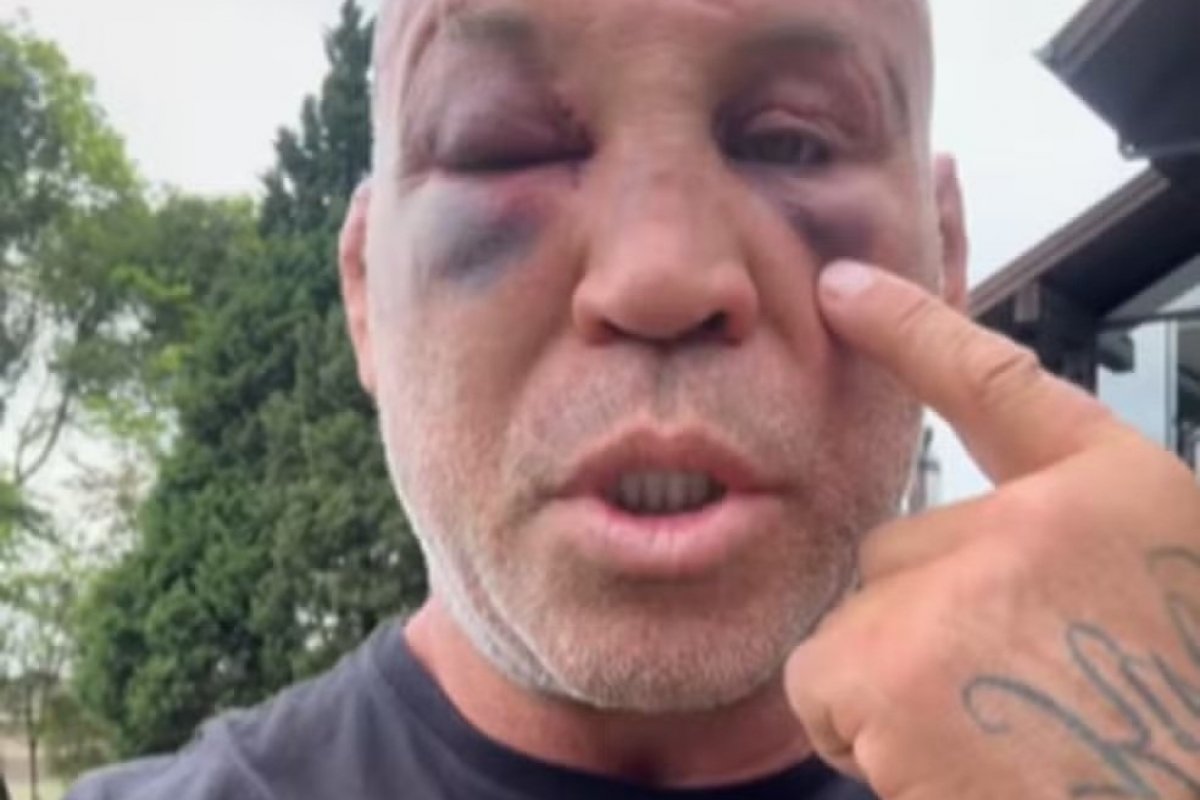 Vídeo: "Fui agredido de forma criminosa pelo filho do Popó", afirma Wanderlei sobre sequelas de luta