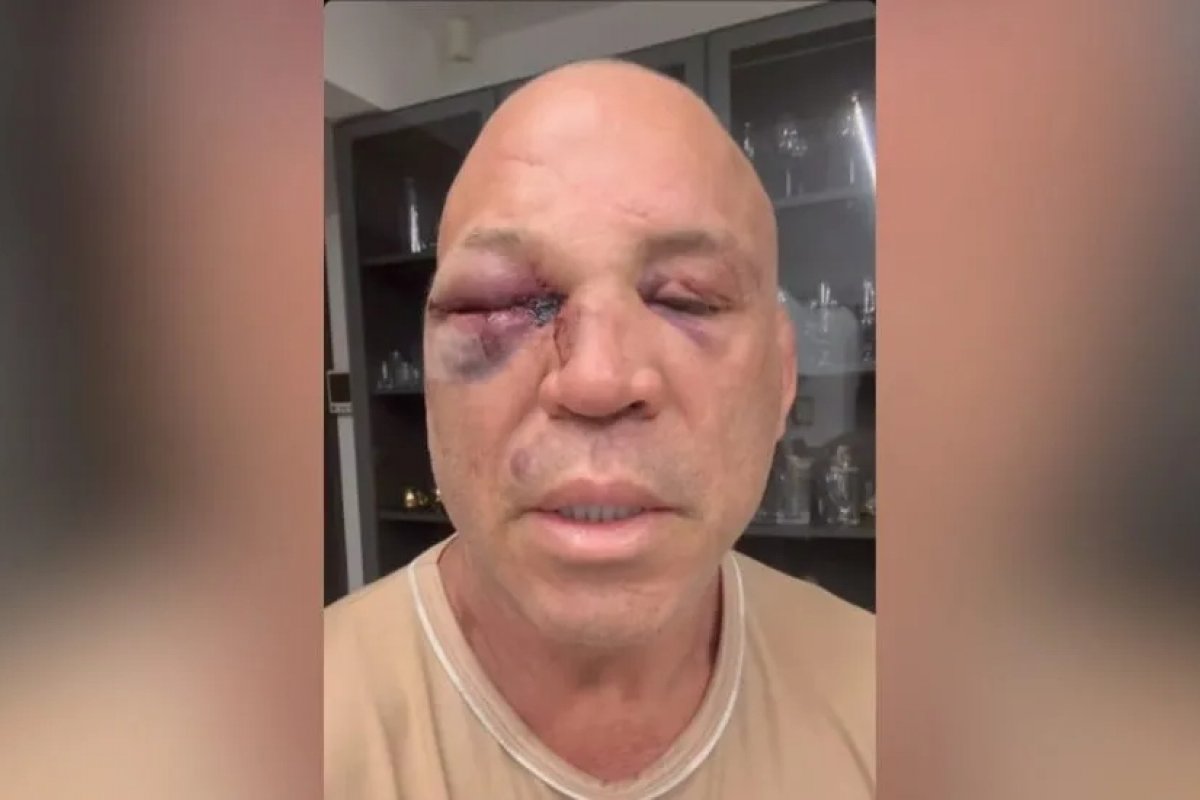 Wanderlei Silva diz que vai à Justiça após pancadaria em luta contra Popó