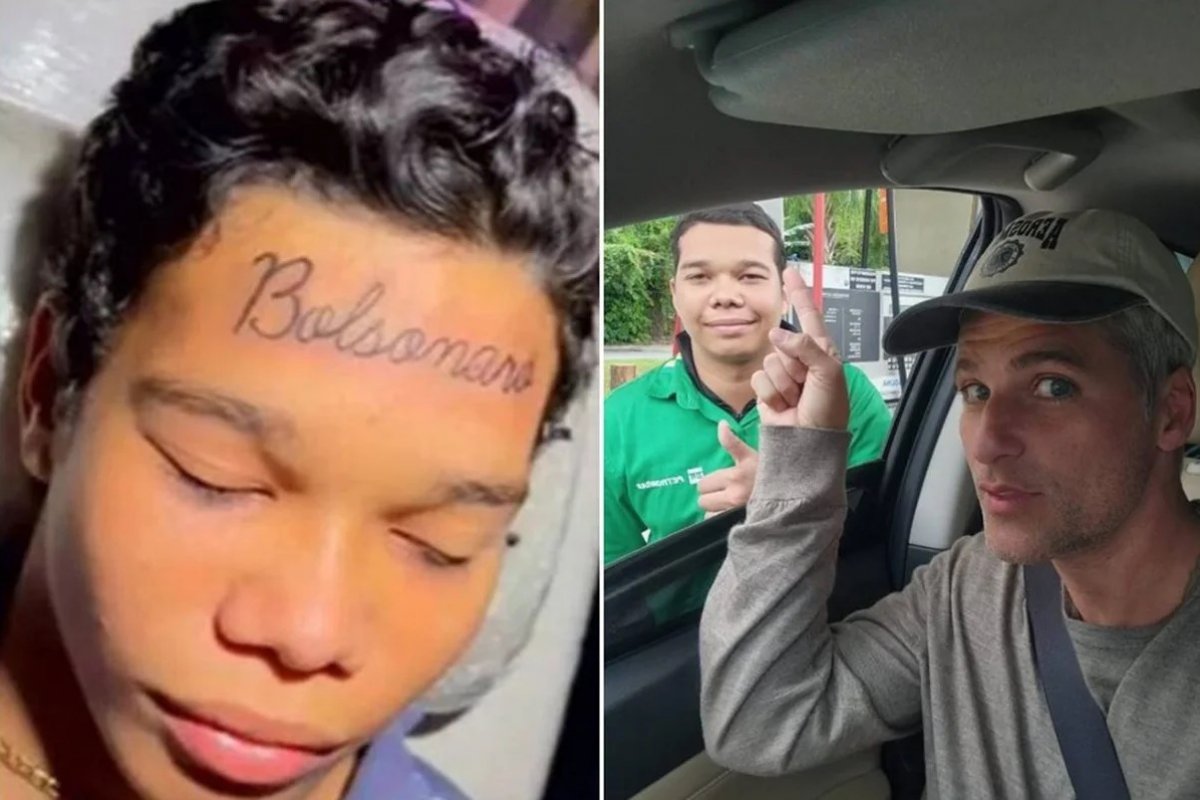 Jovem que tatuou “Bolsonaro” na testa em 2022 remove marca e aponta arrependimento